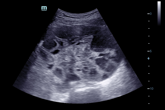 Mindray DC-60 Exp X-Insight