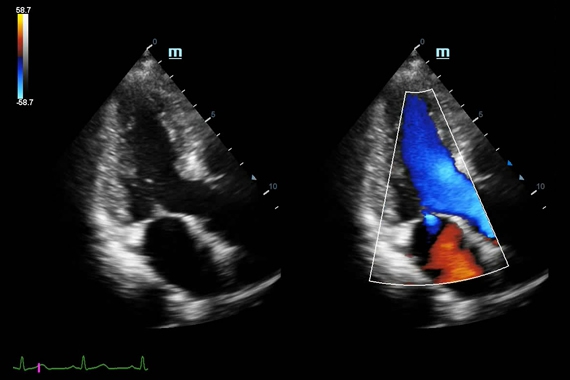 Mindray DC-70 pro X-Insight