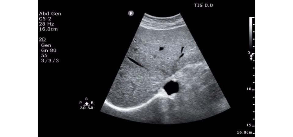 Philips ClearVue 850