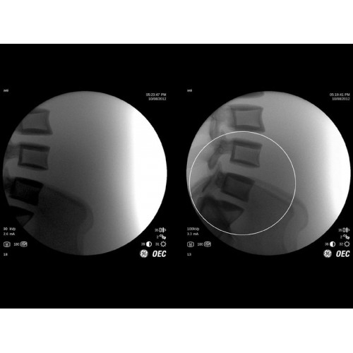 Моноблочный рентгенохирургический аппарат GE Brivo OEC 785/865