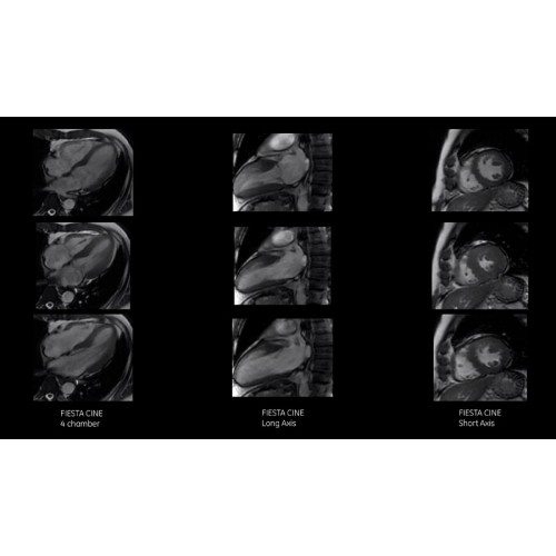 МРТ аппарат GE SIGNA Pioneer 3.0T