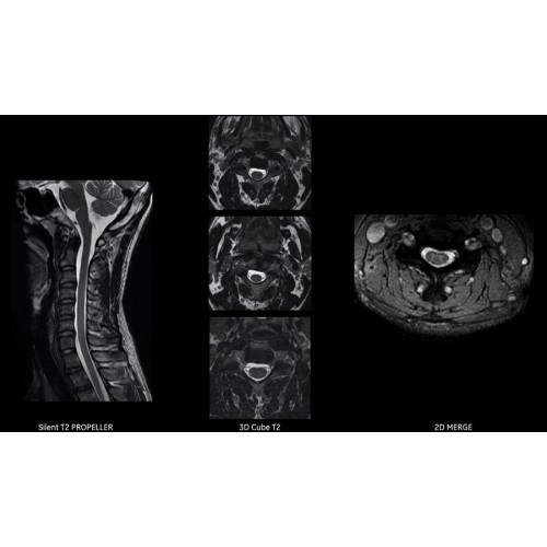 МРТ аппарат GE SIGNA Voyager 1.5T